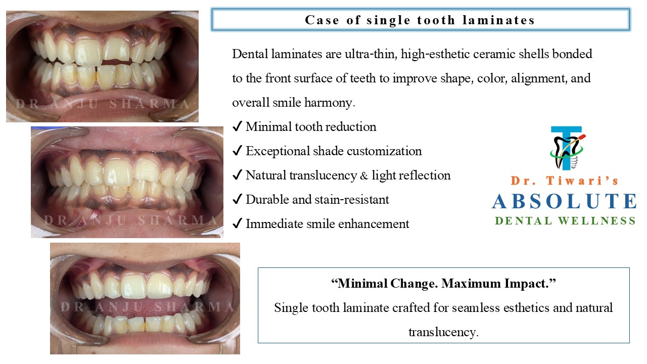 Smile Transformation 3